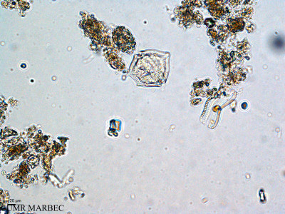 phyto/Thau_Lagoon/THAU_station1/GELAMED 2010/Protoperidinium curvipes (ancien Protoperidinium sp21 -P. pellucidum-2)(copy)_thumb.jpg